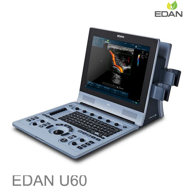 Edan U60 Diagnostic Ultrasound System cost - EKON