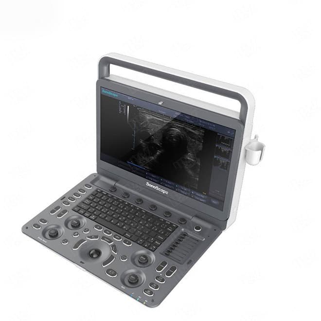 Digital intelligent color doppler ultrasound scan Sonoscape E2