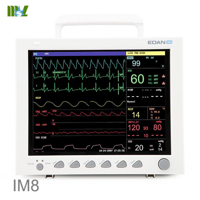 Patient monitor | patient monitoring devices iM8