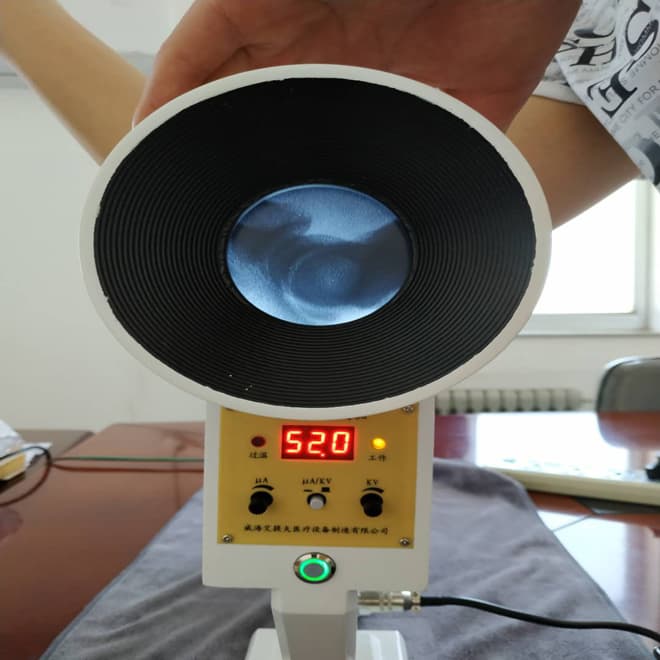 Portable Mobile X-ray Imaging System EKONPX31 for sale