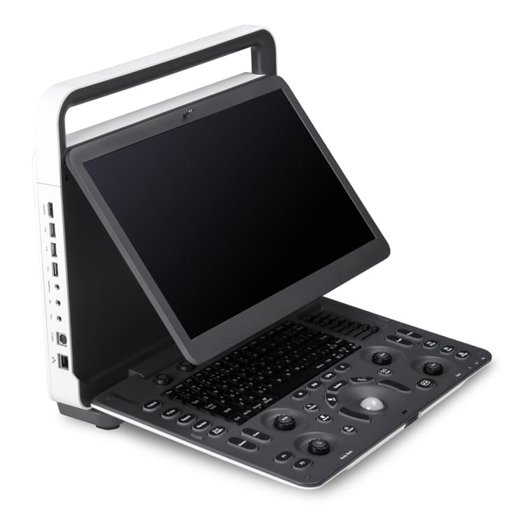 Digital intelligent color doppler ultrasound scan Sonoscape E2
