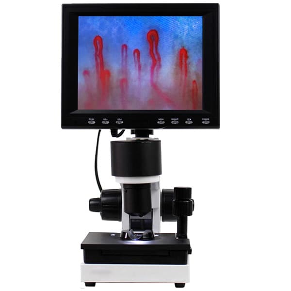 High Resolution Nail fold blood microcirculation test machine EKONXW01