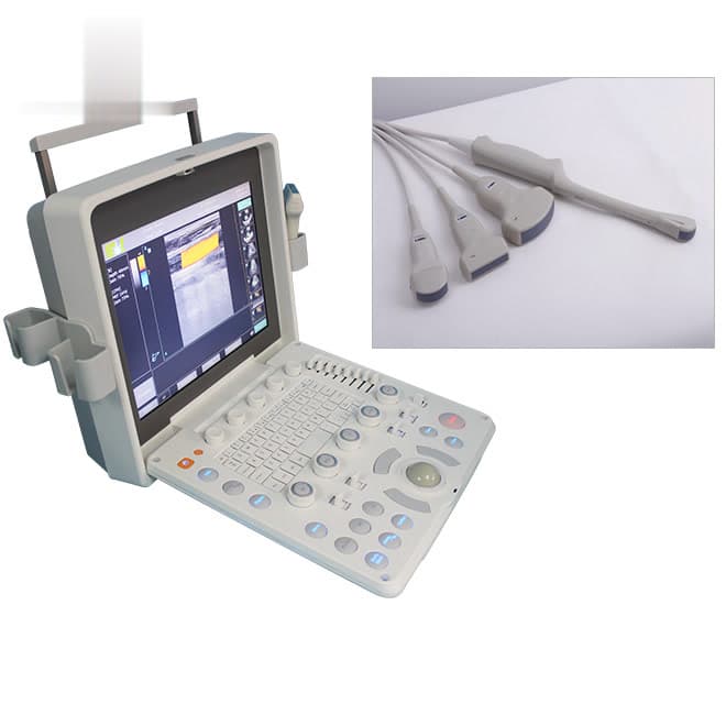 Colour doppler ultrasound in pregnancy : abdominal ultrasound EKONCU36
