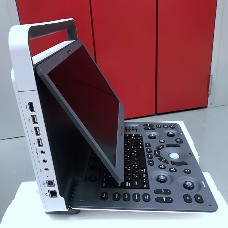 Digital intelligent color doppler ultrasound scan Sonoscape E2