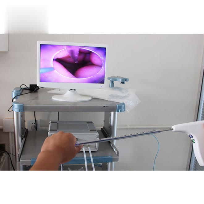 Canine visual infusion tool for artificial insemination EKONDE01