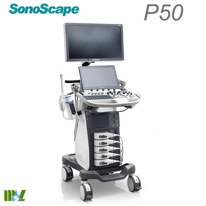 Sonoscape p50 4d scan ultrasound machine - EKON