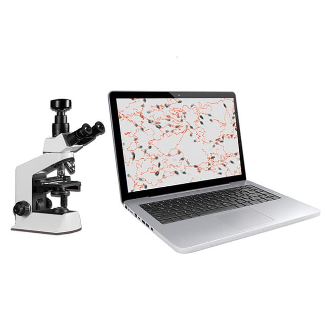 High quality EKON3705 automated sperm analyzer