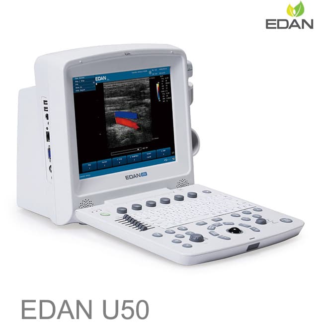 FDA approved colour doppler ultrasound pregnancy EDAN U50
