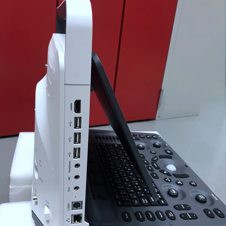 Digital intelligent color doppler ultrasound scan Sonoscape E2