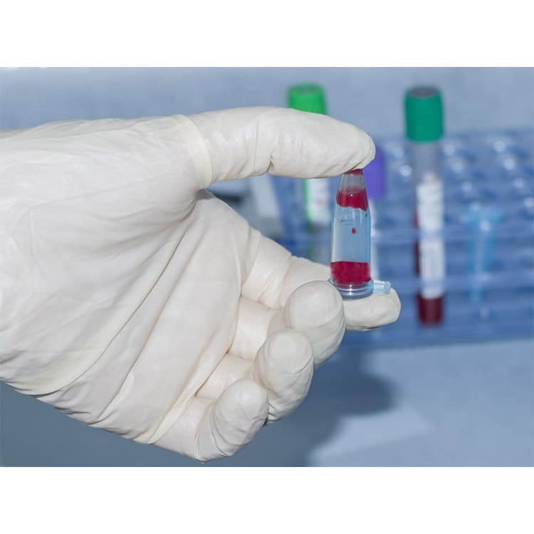 haematology analyser