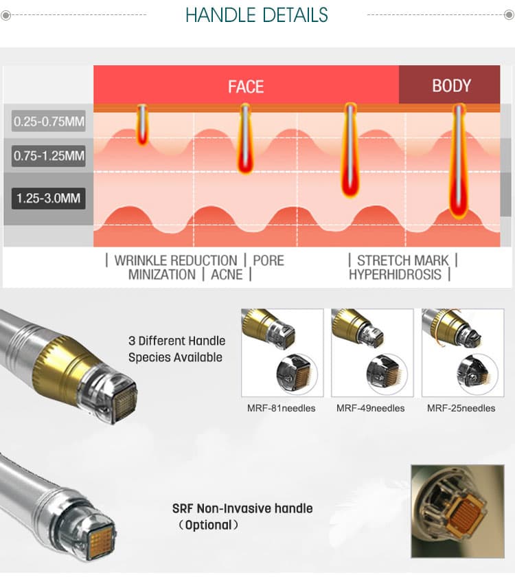 RF MICRONEEDLE