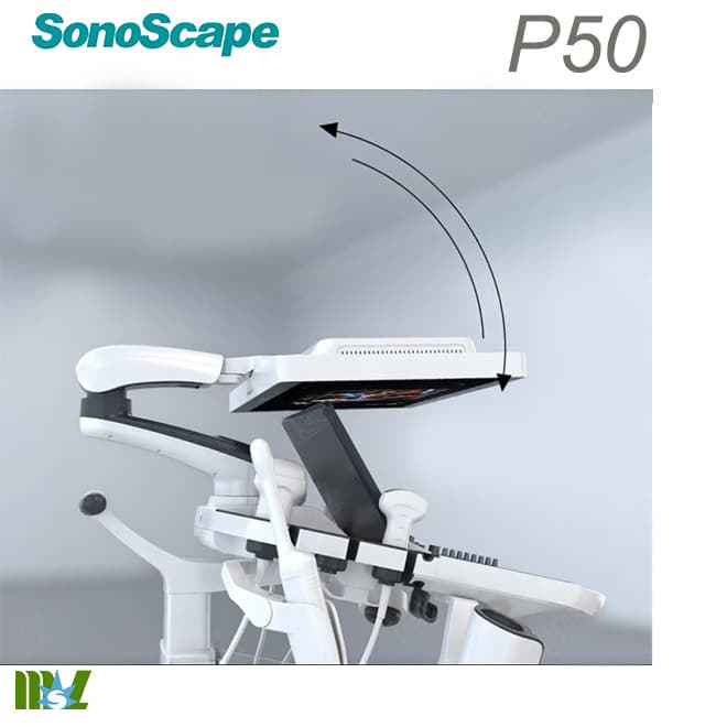 doppler ultrasound sonoscape p50