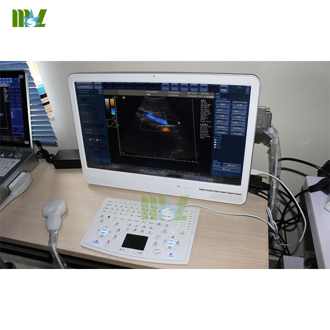 Newest touch screen laptop ultrasound machine MSLCU29 for sale