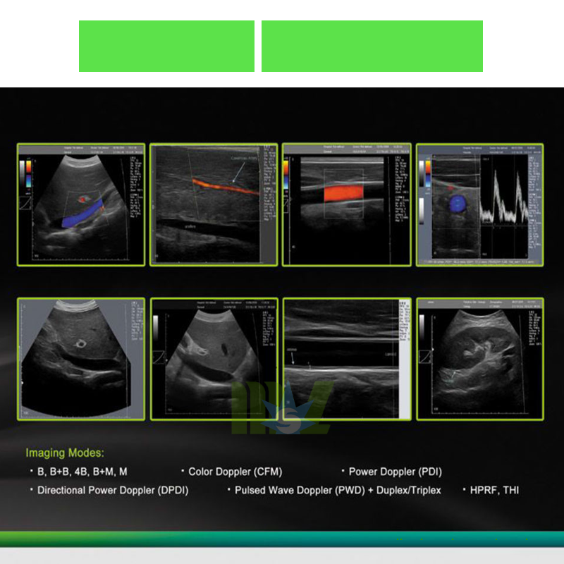 Newest touch screen laptop ultrasound machine MSLCU29