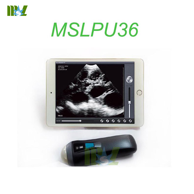 MSL portable wireless ultrasound probe MSLPU36 working with iphoneipad