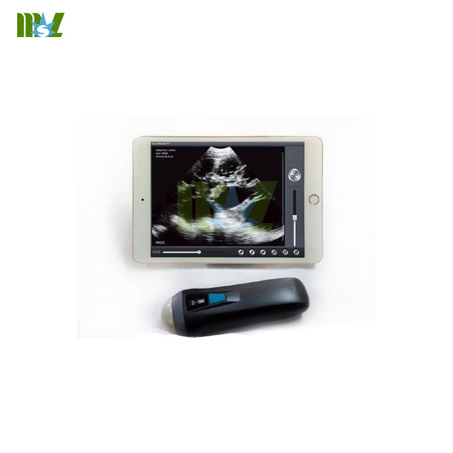 wireless ultrasound probe MSLPU36 working with iphoneipad