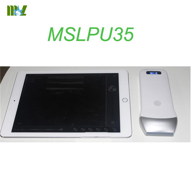 MSL wireless ultrasound Scan linear Probe MSLPU35