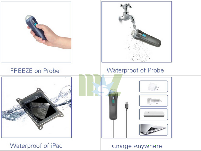 new wireless ultrasound probe MSLPU36 for sale