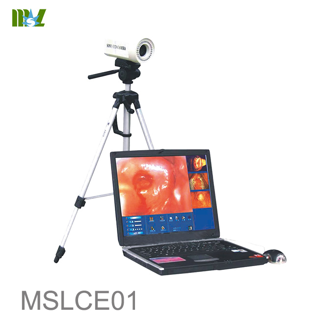 Laptop Colposcope MSLCE01