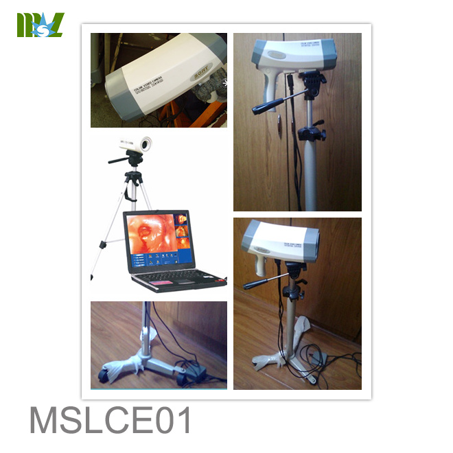 Laptop Colposcope for Women Use MSLCE01