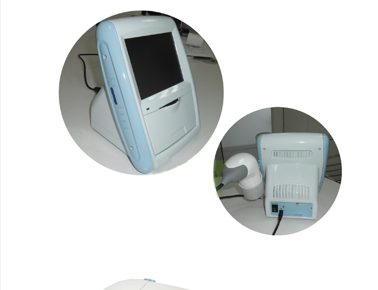 Portable 3D Ultrasound Bladder Scanner Machine