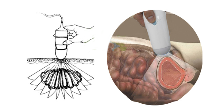 BladderScan / ultrasound bladder scanner