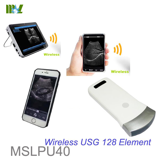 128 Element WIFI ultrasound