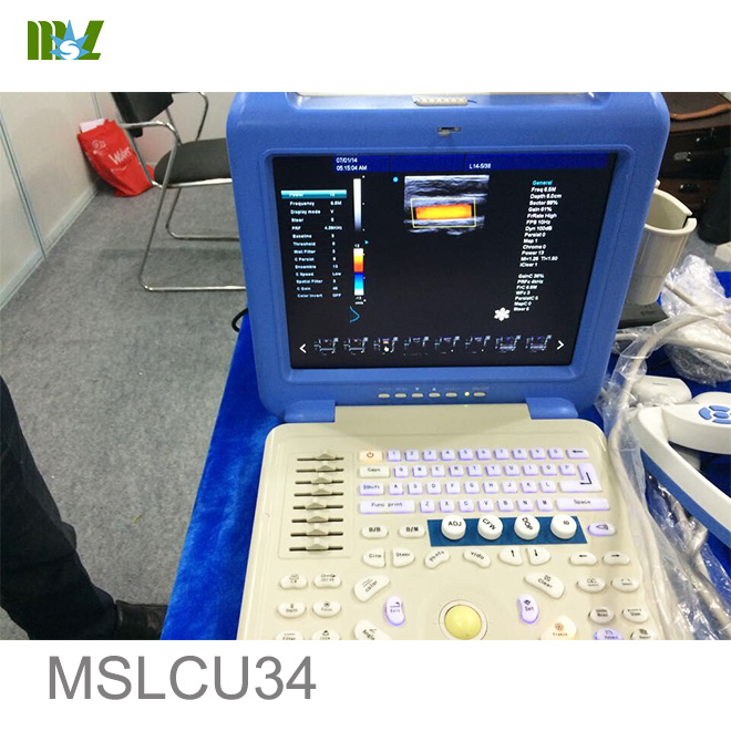 best Ultrasound Scanner MSLCU34