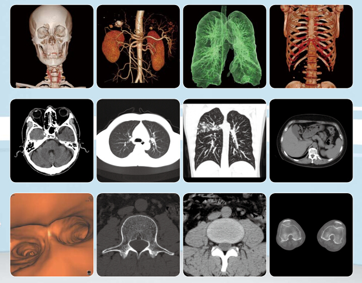 Advanced CT Scanner MSLCT16