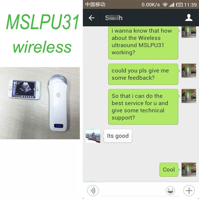 The India customer feedback of MSLPU31 for sale