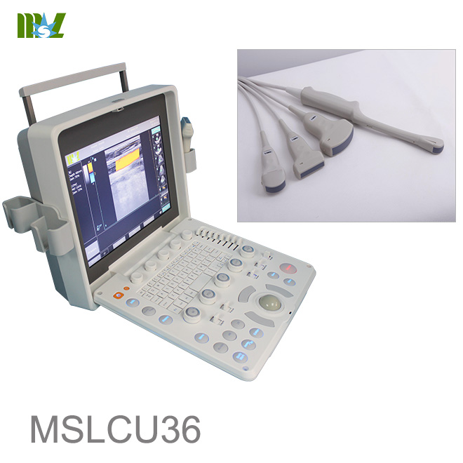 abdominal ultrasound MSLCU36