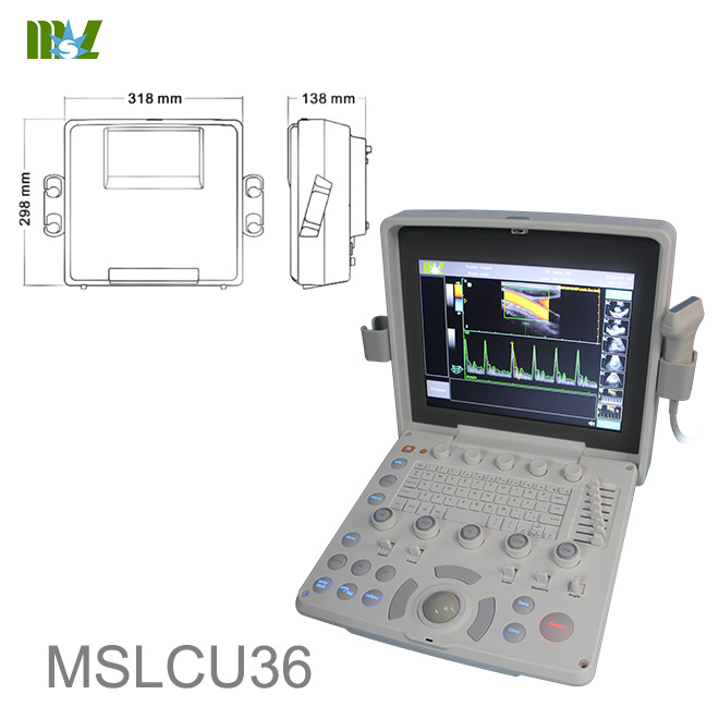 Colour doppler ultrasound in pregnancy