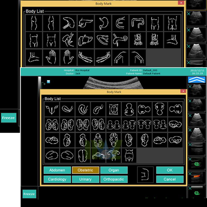 doppler ultrasound cost