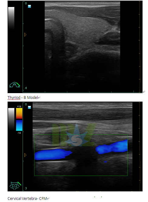 how does doppler ultrasound work