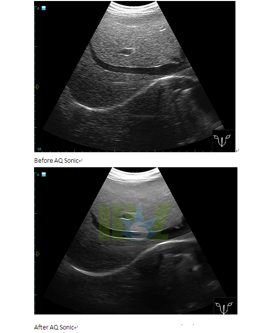 colour doppler ultrasound during pregnancy