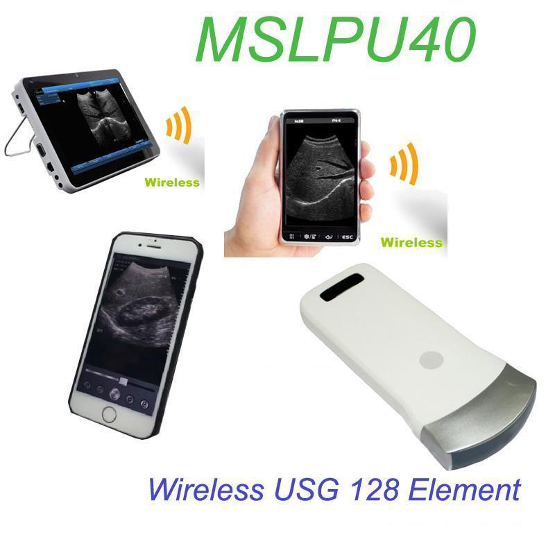 Wireless USG 128 Element Ultrasound Convex Probe