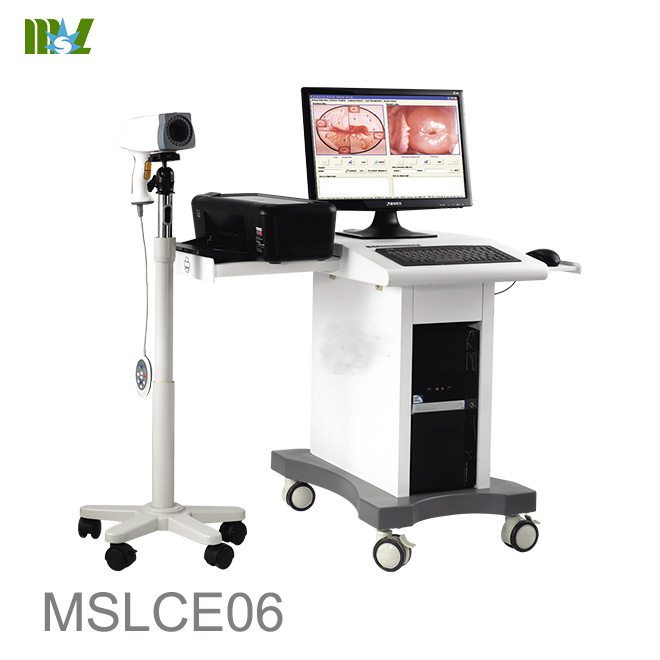 Colposcope video machine for gynaecology MSLCE06