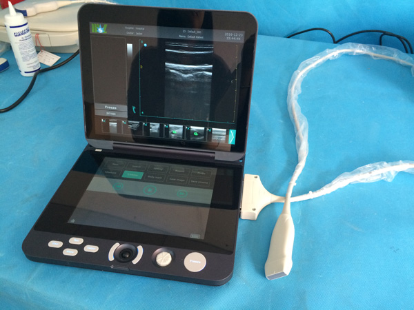 Best ultrasound machine MSLPU44