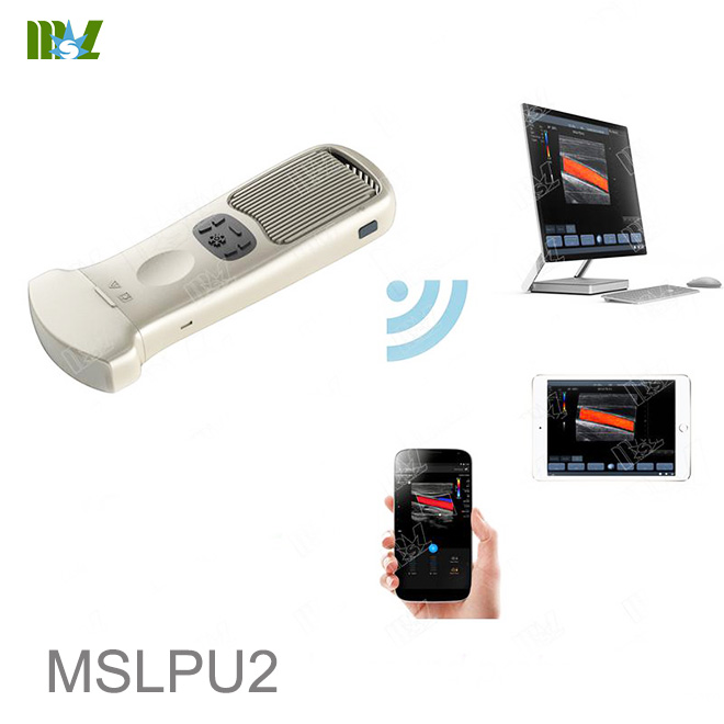 mobile ultrasound