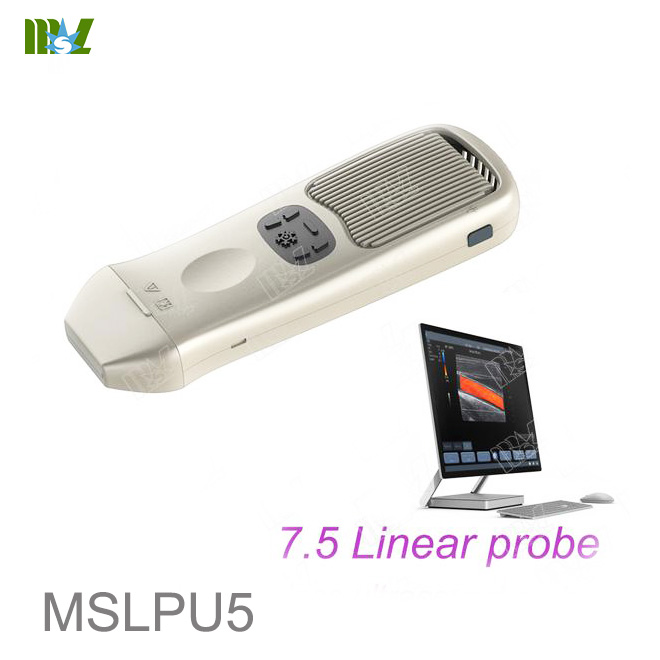 ultrasound machine price