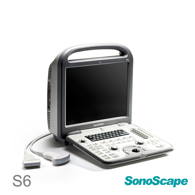 SonoScape S6