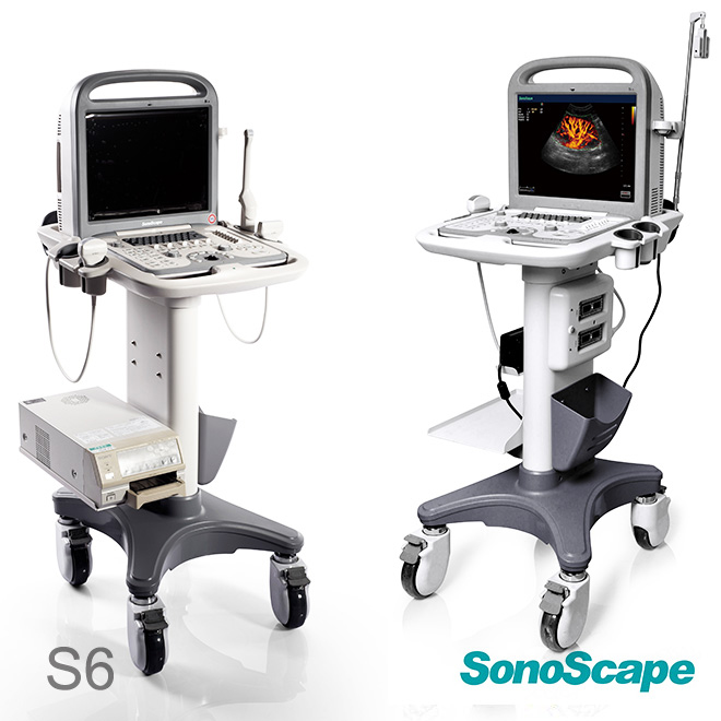 sonoscape ultrasound