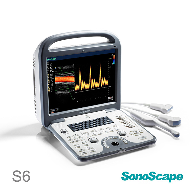 SonoScape S6 price