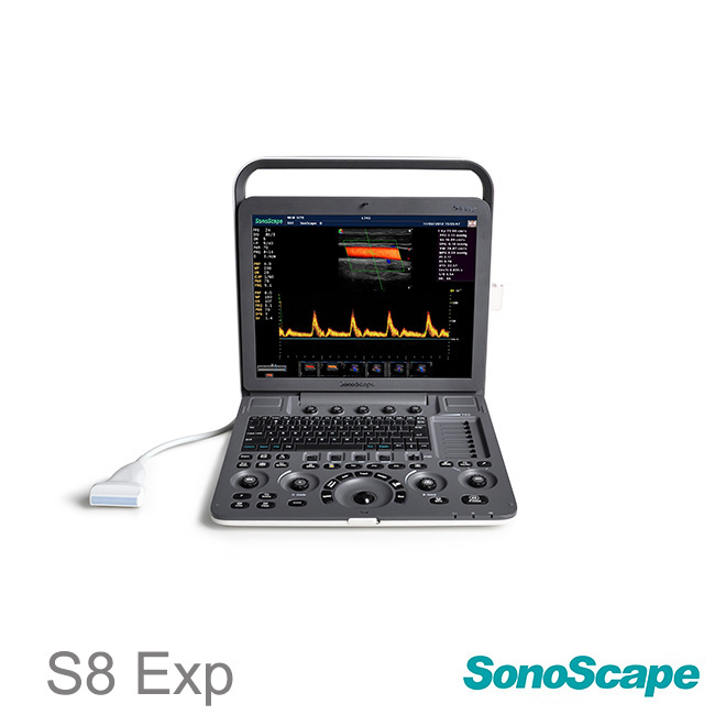 SonoScape S8