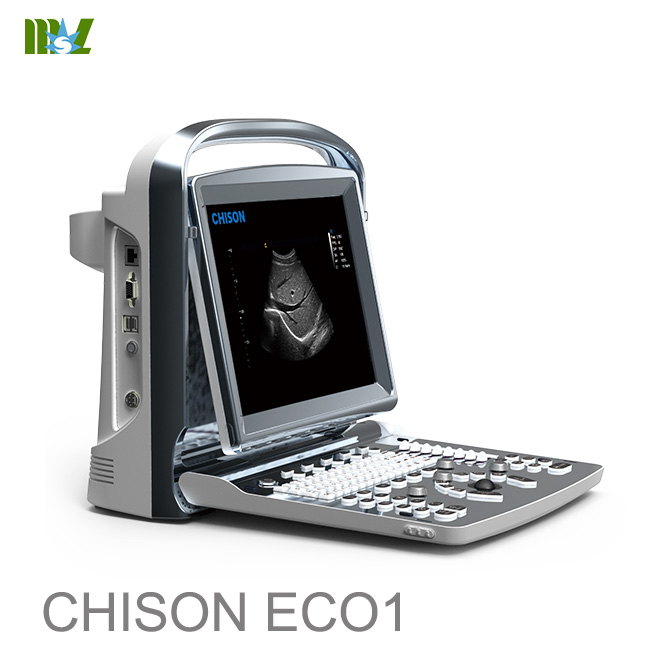 ultrasonido abdominal chison eco 1