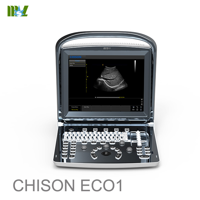 ultrasonido doppler chison eco 1