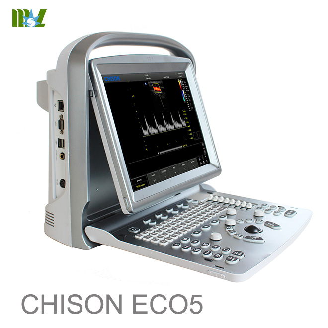 ultrasonido abdominal chison eco 5