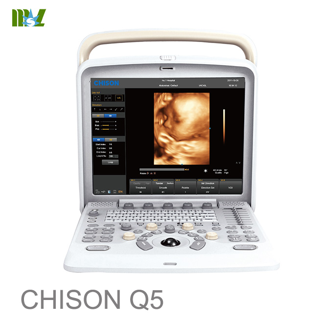 ultrasonido 4d chison q5