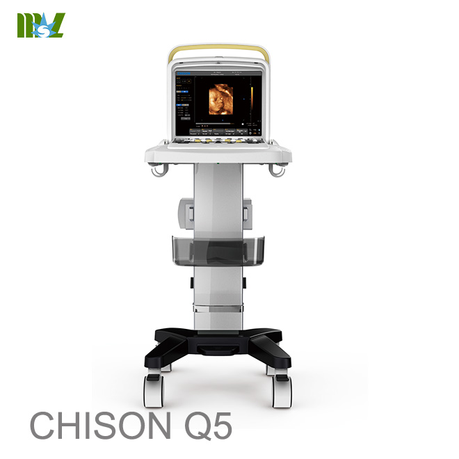 ultrasonido de embarazo chison q5