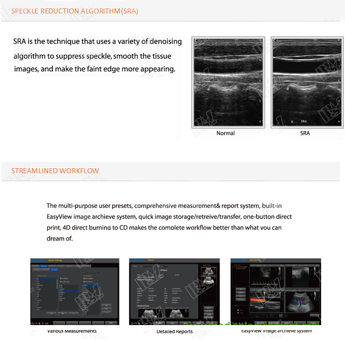 ultrasonido abdominal chison q5